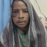 श्री मेडिशाइन हॉस्पिटल में भालू के हमले में घायल महिला का सफल उपचार.